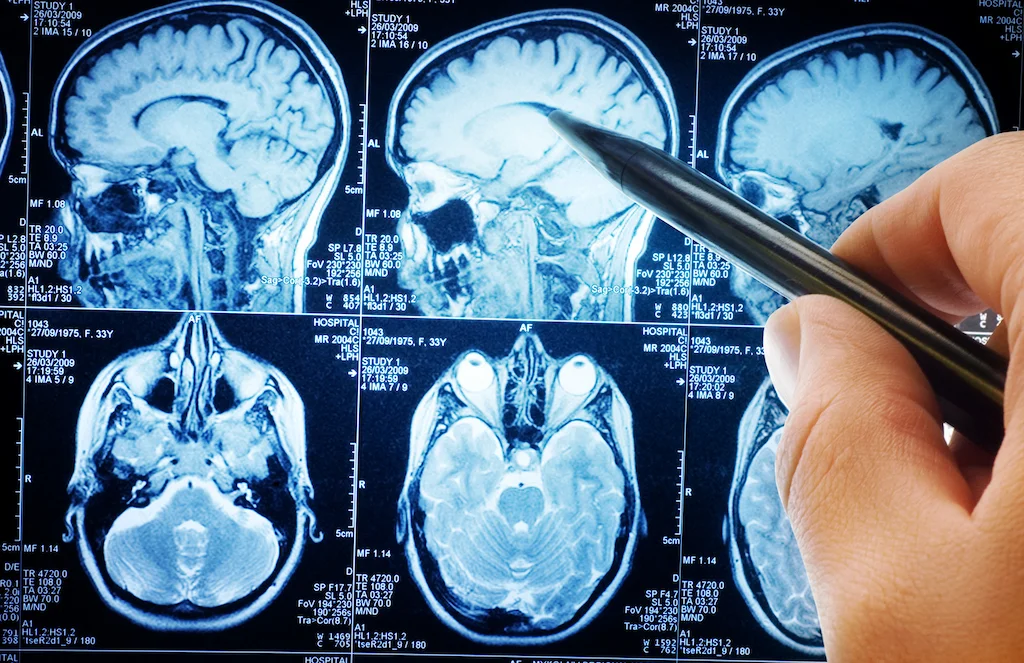 Neurologia e Psichiatria – Studio Medico Antium